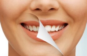 Cosmetic Dentistry Treatment Options That Can Help You Fix Your Smile